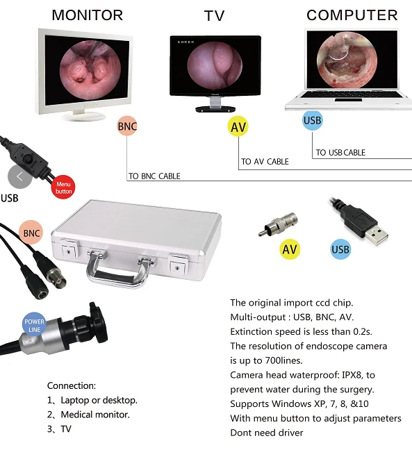 medical USB camera system for ENT endoscopy USB portable camera
