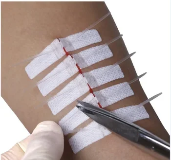 Waterproof local skin wound closure suture sterile strips for hospital use repair wound care skin closure sterile strip
