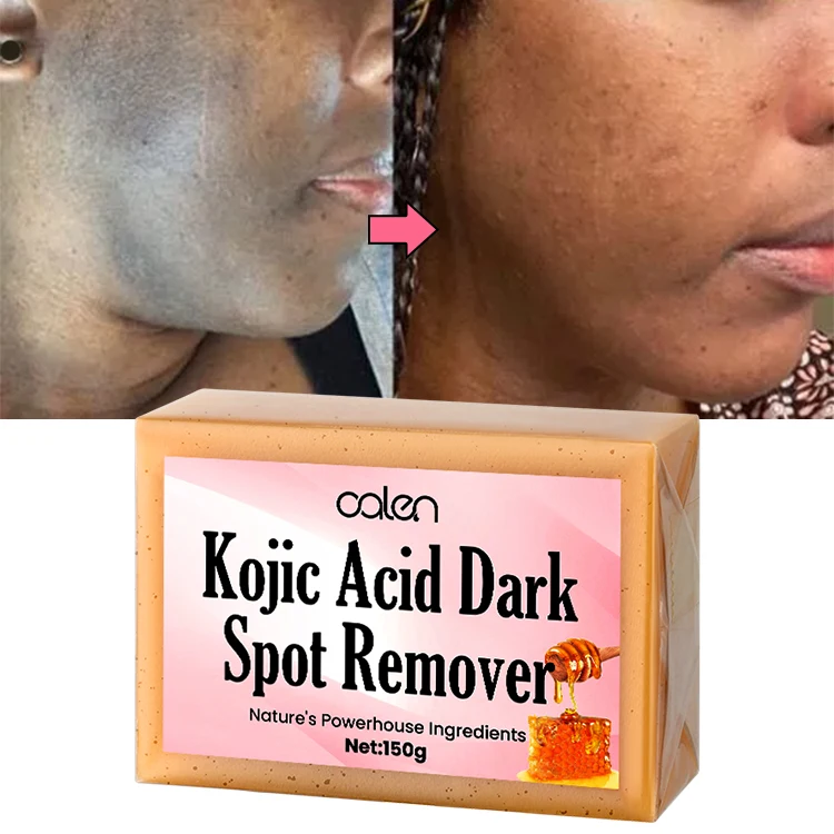 Oalen Private Label Vegan Organic Moisturizing Face Lemon Turmeric Kojic Acid Soap
