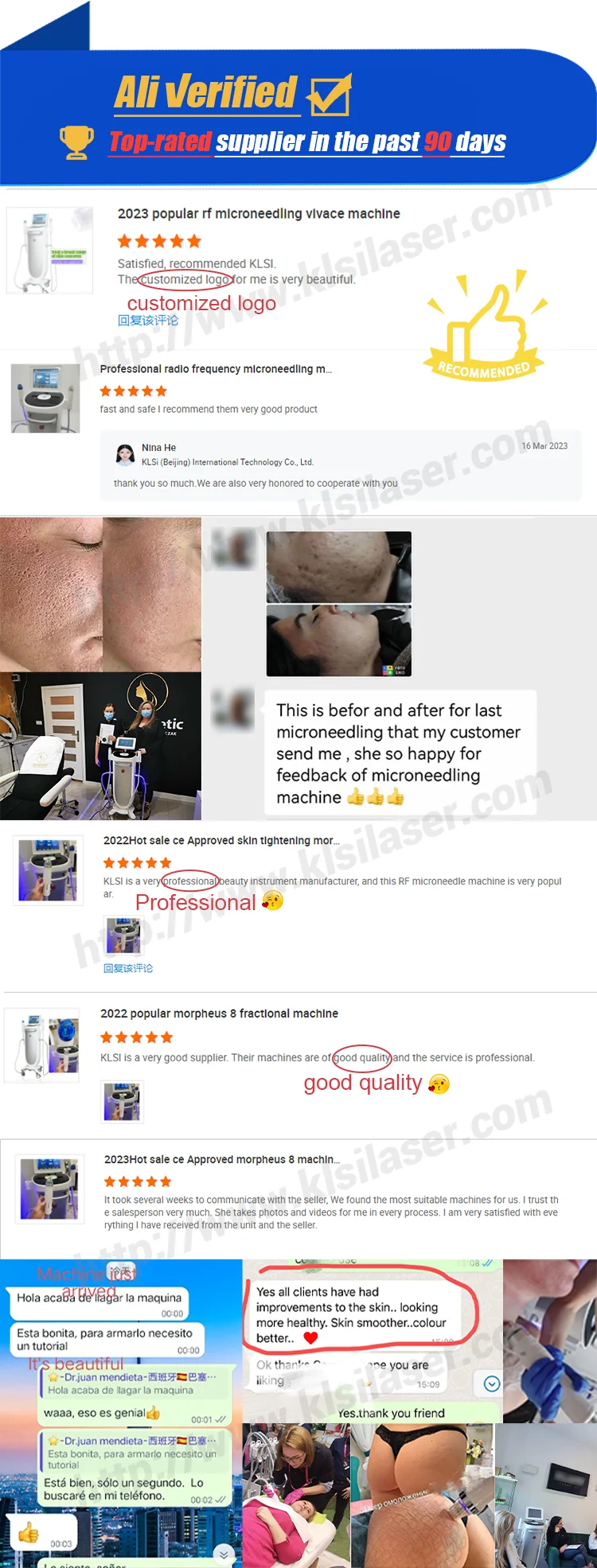 New Design ! Manufacturer Direct Sales ! what will a morpheus8 rf microneedling treatment d