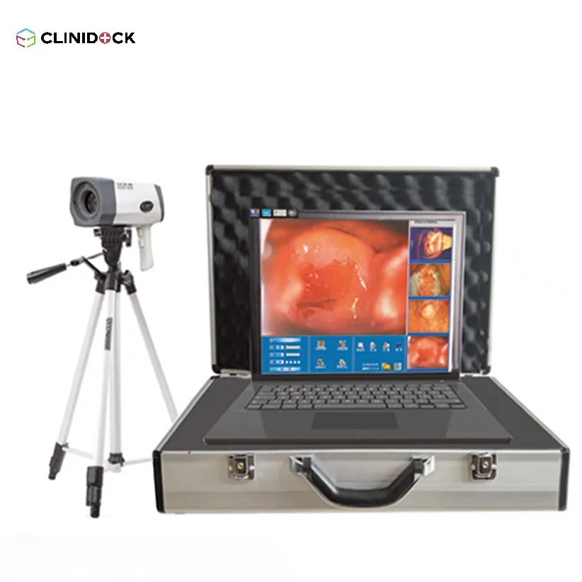 High end Portable Digital Electronic Colposcope, video colposcope for vagina CD-GJ-A8000A