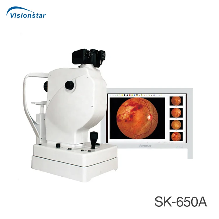 Popular Model SK-650B Non-mydriatic Fundus Camera