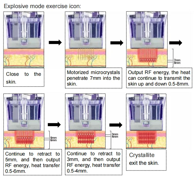 OEM logo  Painless newest arrivals big power Commercial original discount good price New Technology nova crystallite depth 8