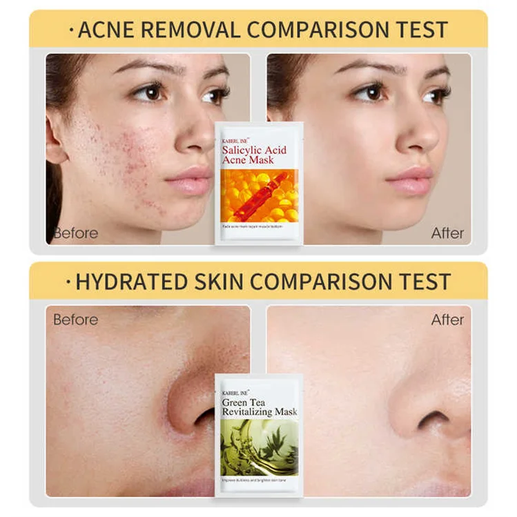 Oem Custom Anti-Aging Face Care Mask Korean Organic Moisturizer Whitening Skin Care Collagen Facial Masks