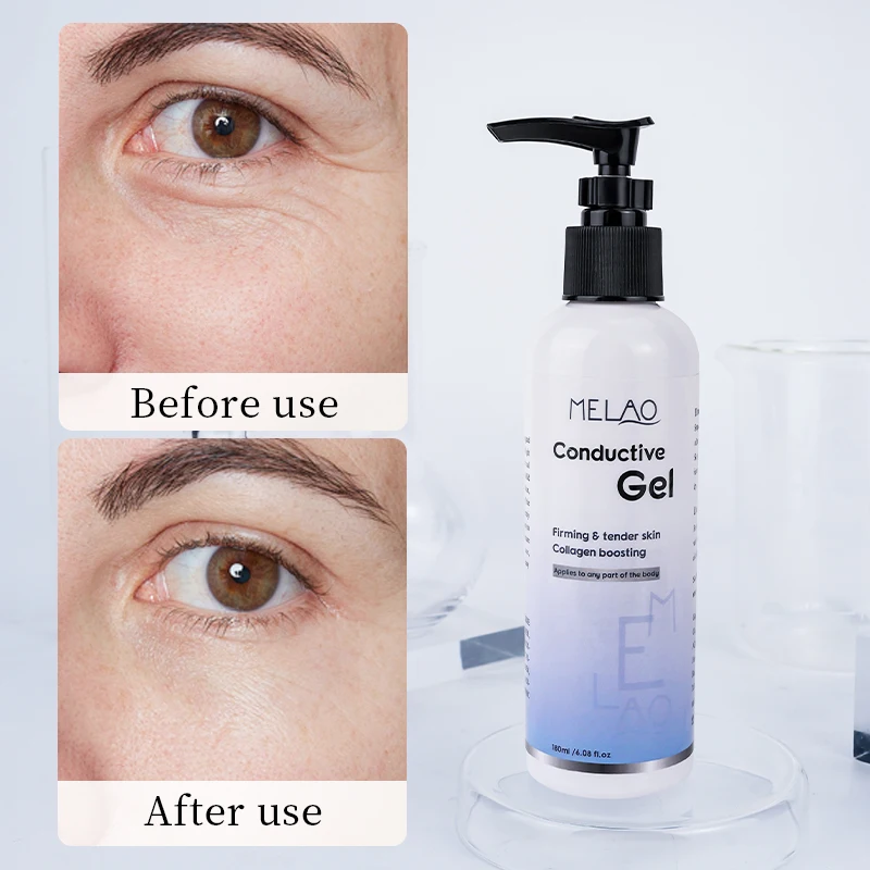 Radio Frequency Gel Cooling Conductive Gel Face Microcurrent Use Rf Facial Machine Radio Frequency Gel