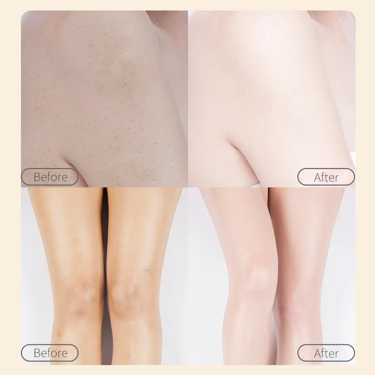 Remove chicken skin body scrub exfoliate body scrub cream private label wholesale organic body scrub private label