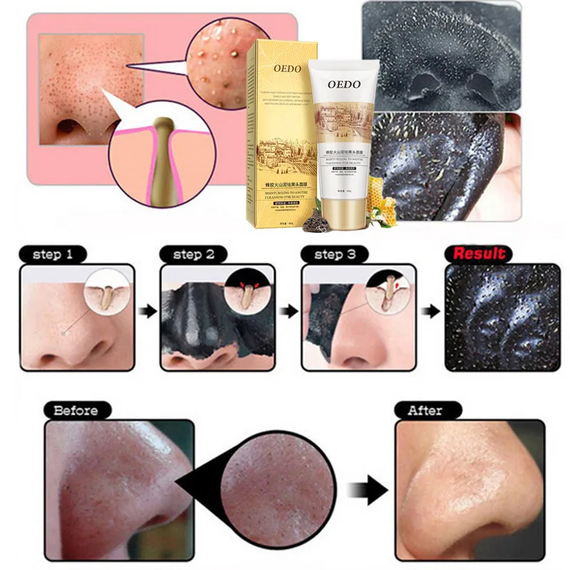 Explosive volcanic mud   facial mask beauty  photon silicone facial mask  brush facial mask  Blackhead removal