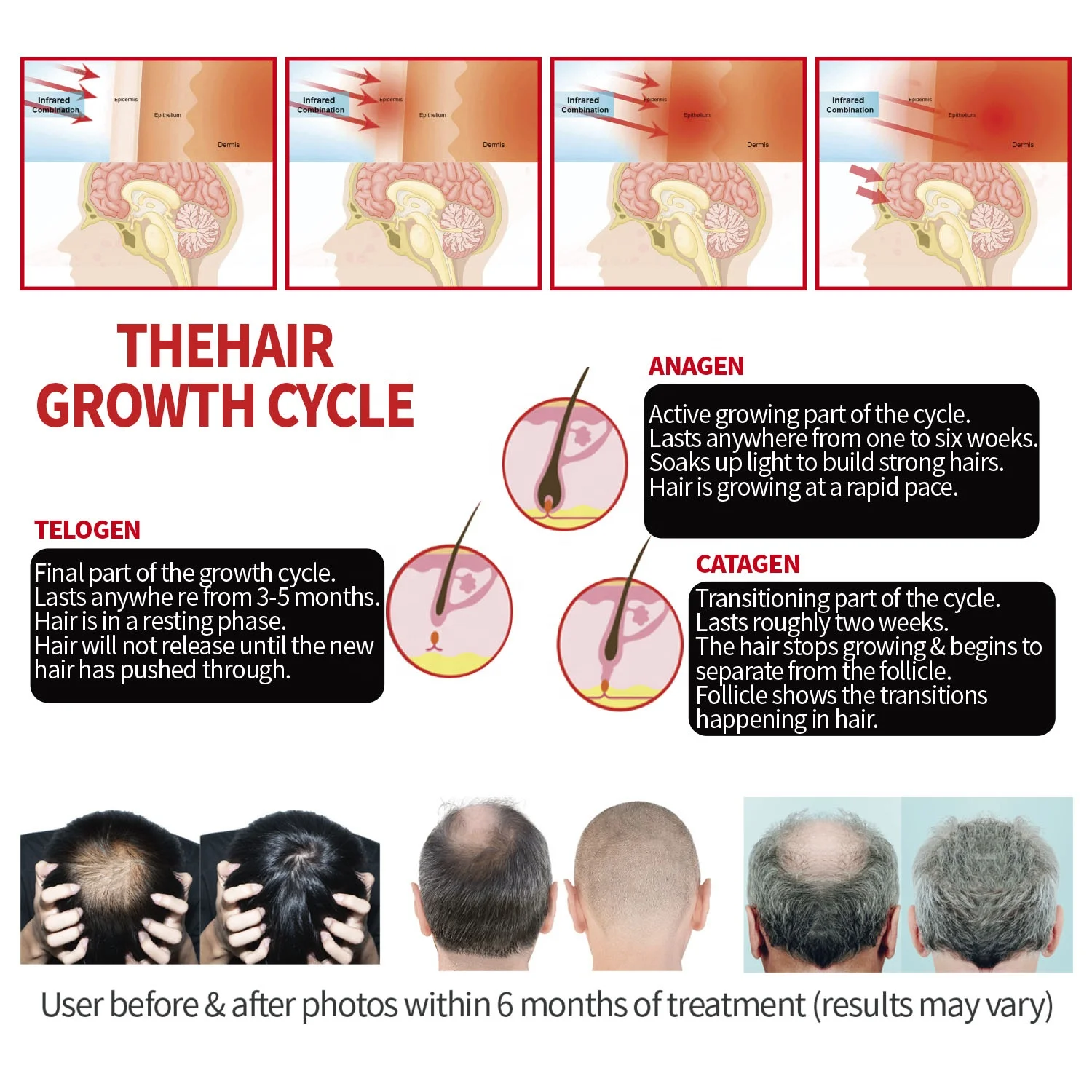 DGYAO Red Light Therapy Helmet Infrared Light Therapy For Hair Loss Heating Red Light Therapy 660nm 850nm