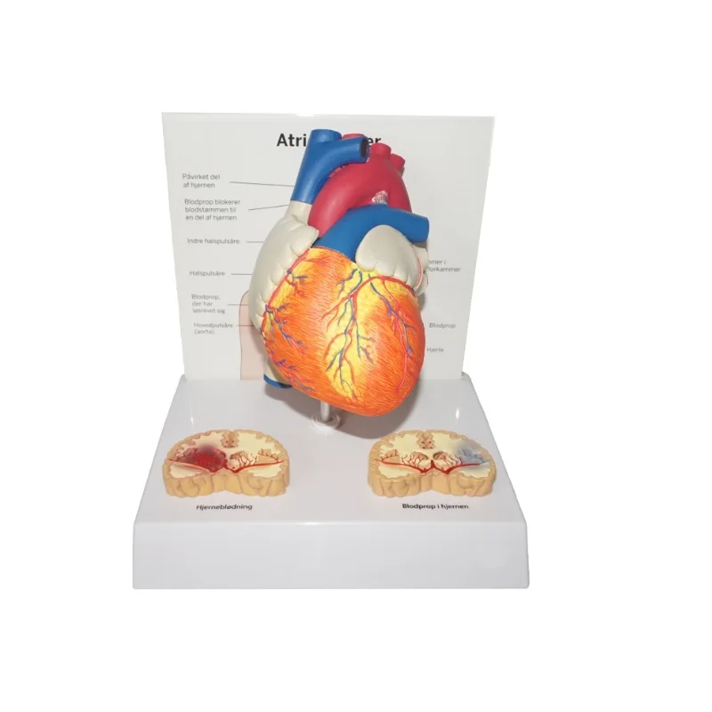 Atherosclerotic Model Heart Disease