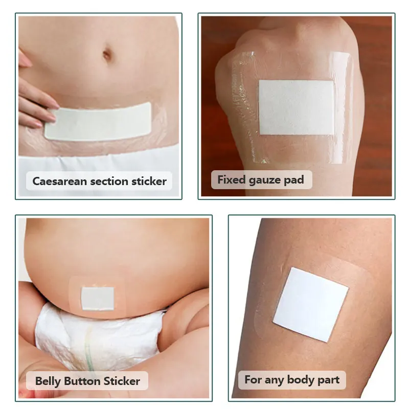 Medical consumables Wound dressing Medical waterproof absorb transparent wound pu film dressing island wound plaster