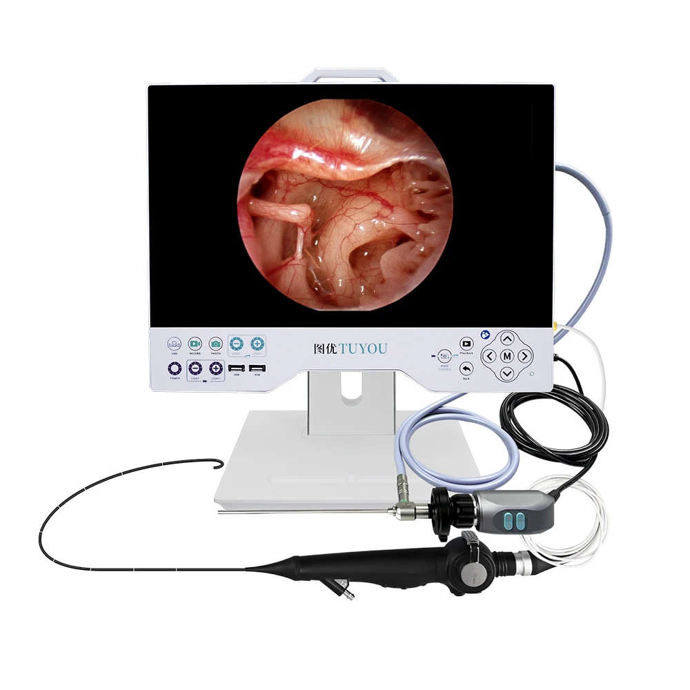 Professional Integrated Medical Full HD 15 inches  Endoscope Camera System for Surgical ENT Laryngoscope Laparoscope