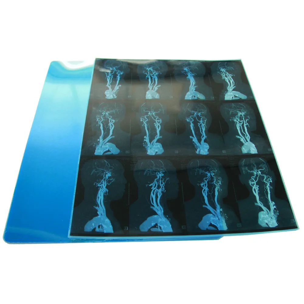 
Cheap price medical thermal film dry imaging laser x-ray film for AGFA FUJI x ray film 