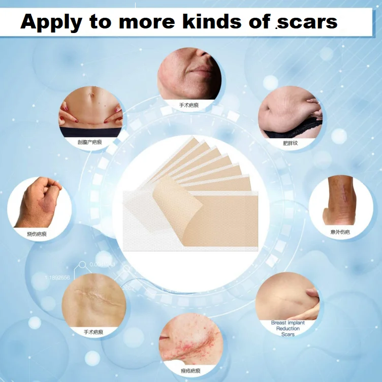 Custom Covering Self Adhesive Surgery Silicone Gel Patch Anti Scar Removal Sheet