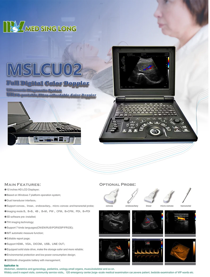 Hot Sale Portable color doppler  Ultrasound Machine With 3d software
