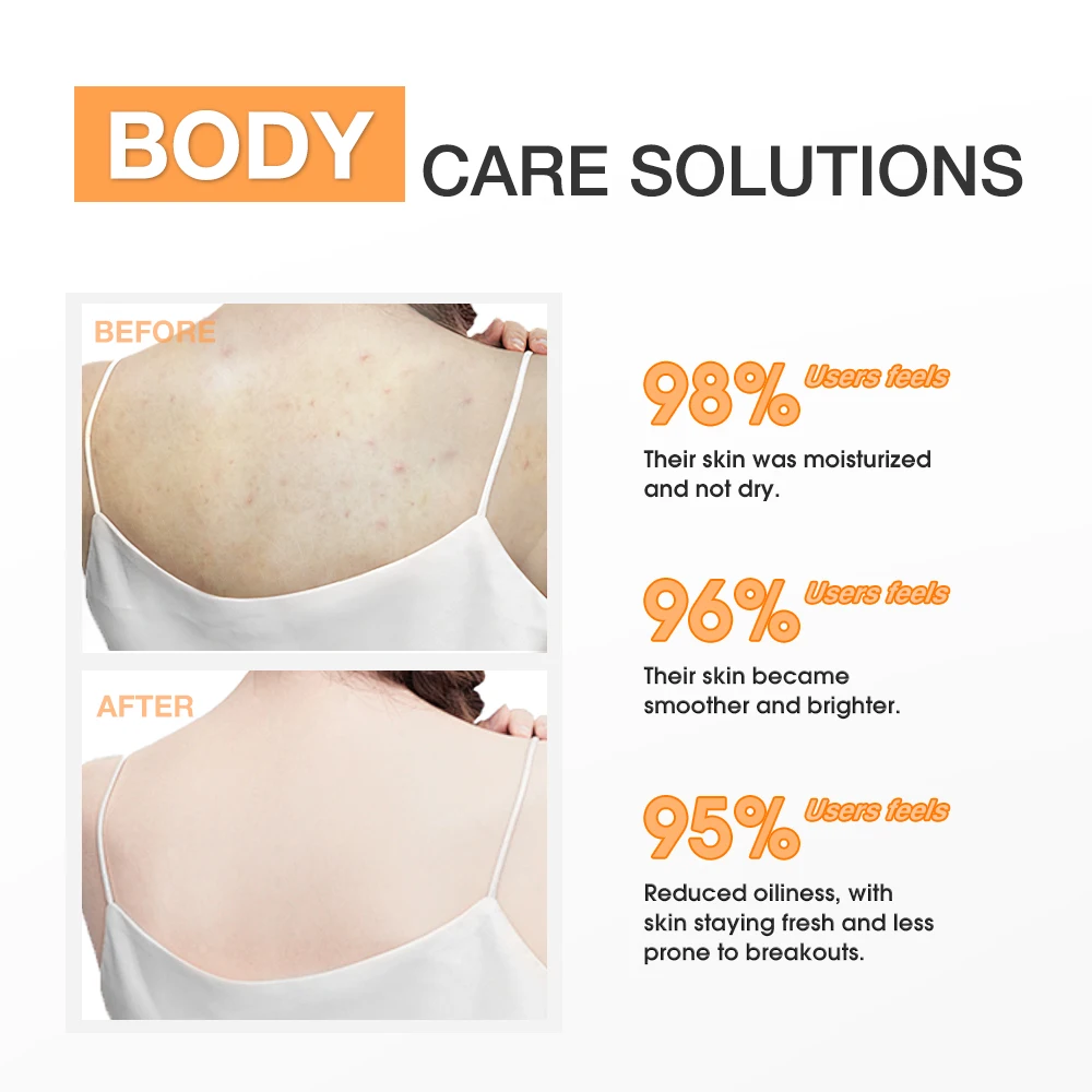 SKINEVER Body Lotion with Salicylic Acid Vitamin C Herbal Ingredients for Exfoliating Whitening Moisturizing Vegan Skin Care