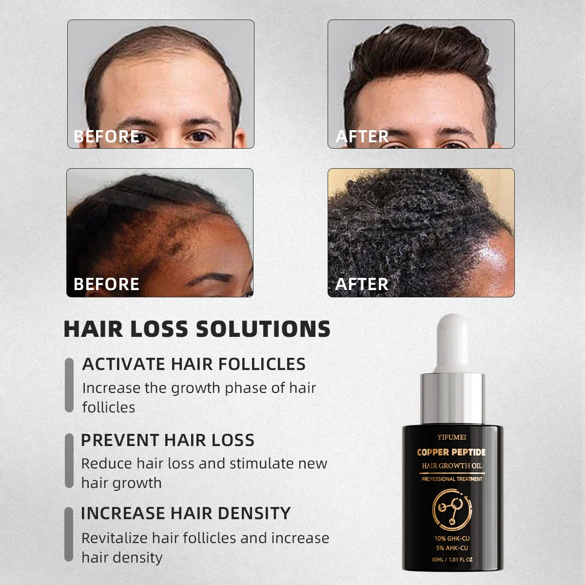 Private Label Organic 7 Days Copper Peptide Hair Growth Serum Oil For Hair Loss Treatment Regrowth Biotin Oil