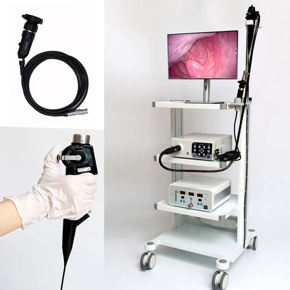 All In One Surgical Hospital Medical Endoscopy Medical Portable Endoscopy Camera System