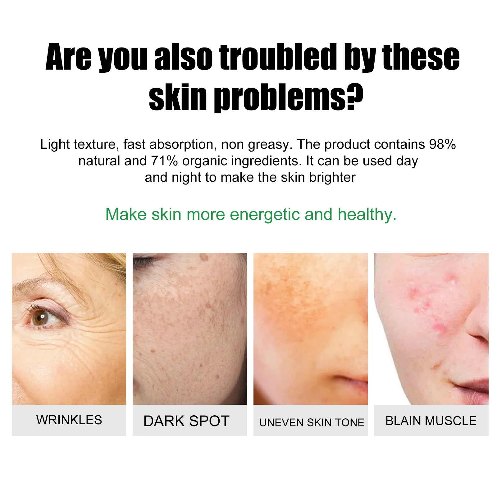 20g Effective Whitening Freckle Cream Remove Acne Dark Spot Fade Pigmentation Melasma Brighten Anti Freckle Cream