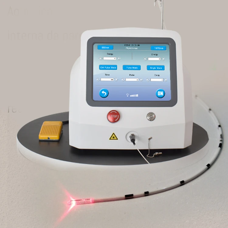 2024 high quality Class IV laser 980nm Anal Fistula surgery laser treatment/1470nm Hemorrhoids Laser Treatment for Proctology