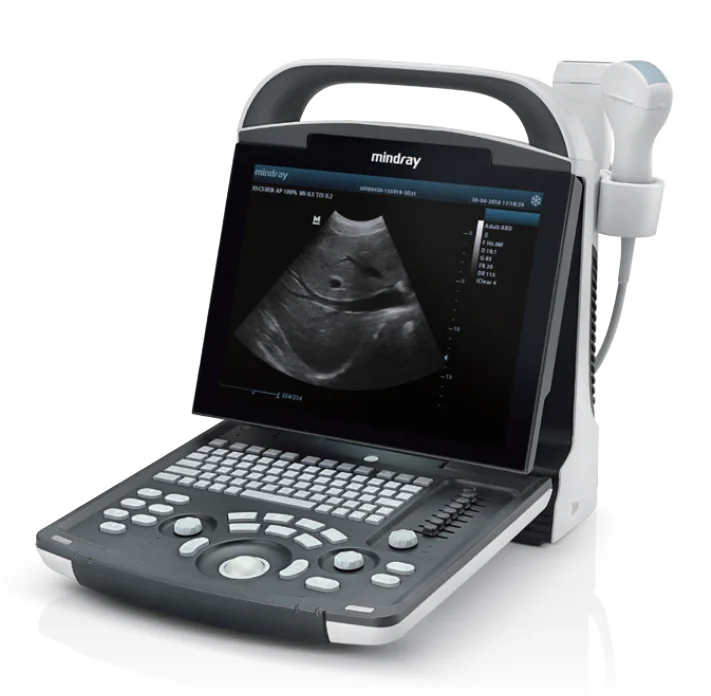Mindray z60 ультразвуковой mindray dp 10 20 аппарат