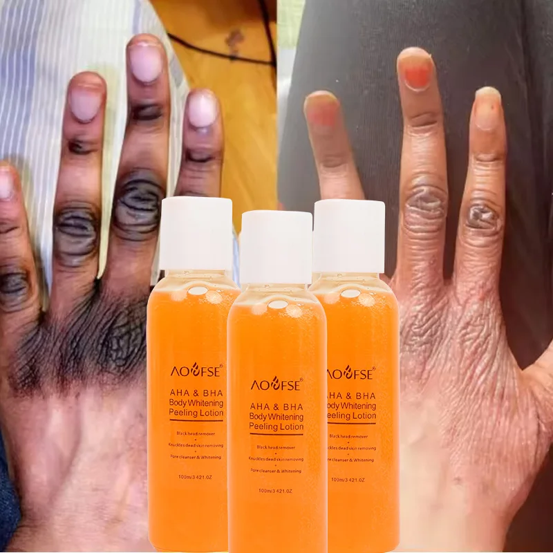 private label body knuckles remover dead extra strong skin whitening exfoliating orange yellow peeling oil