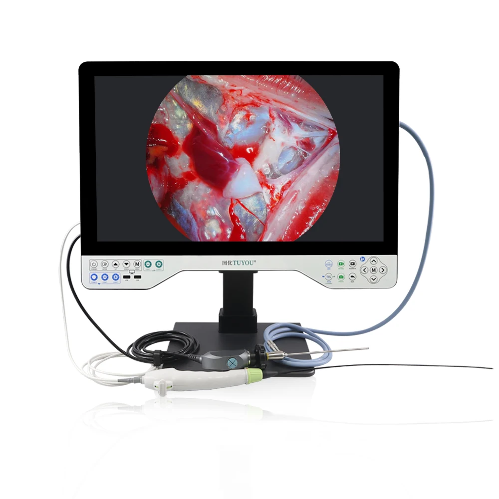 Hot selling 24 Inch Flexible And Rigid All In One Endoscope Camera For Hospital