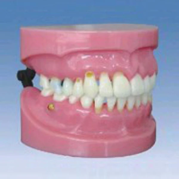 BIX-L1022 Comprehensive dental clinical symptoms teaching model periodontal disease demonstration model