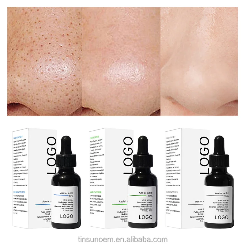 OEM/DOMacne treatment Black Head Remover Beauty Face Skin Care Anti Acne Removal Azelaic Acid Serum Products