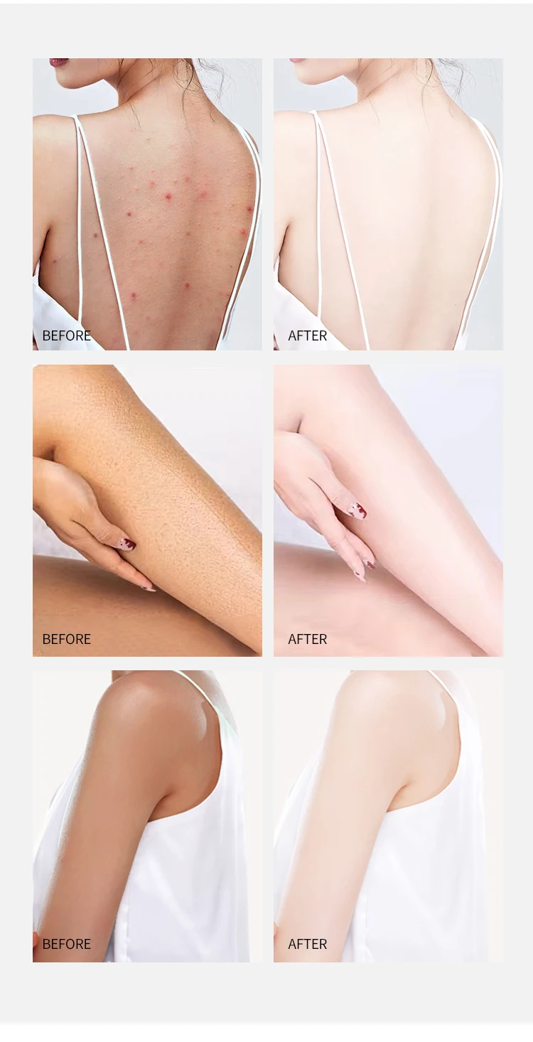 3 Pack Whitening Exfoliating Mango Peach Avocado Bodyscrub Supplies Natural Vegan Shea Butter Skin Care Body Scrub