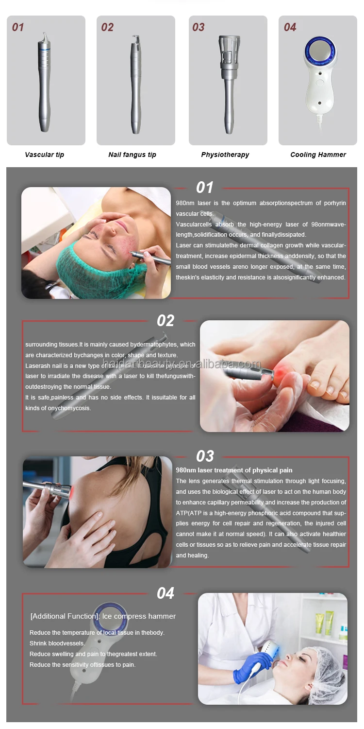 980nm diode laser (3)