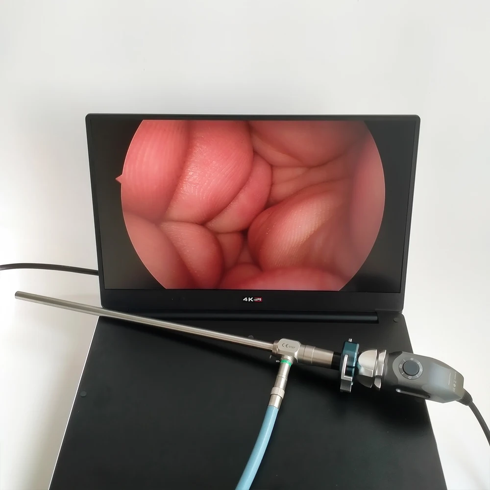 Medical portable Rigid Endoscope Sinuscope camera otoscope laryngoscope USB 3.0 Full HD 1920x1080P laparoscopic camera