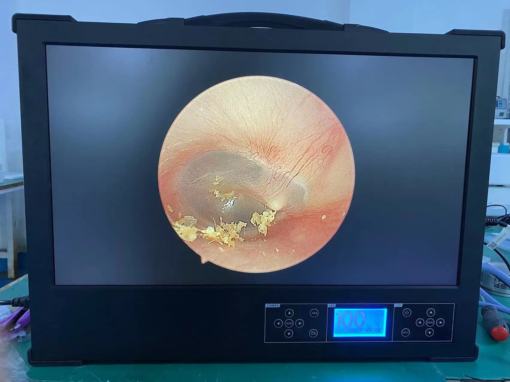3 In 1 Medical Portable Endoscope Camera for Endoscopy USB HDMI HD 1080P Endoscope Camera System with Light Source