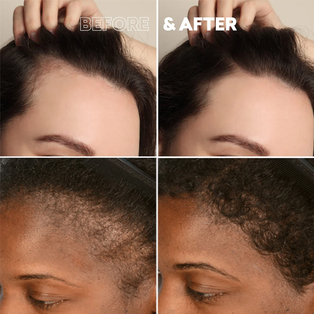 Private Label Natural Ginger Shampoo Treatment Hair Growth Anti Hair Loss Shampoo and Conditioner Set for Men and Women