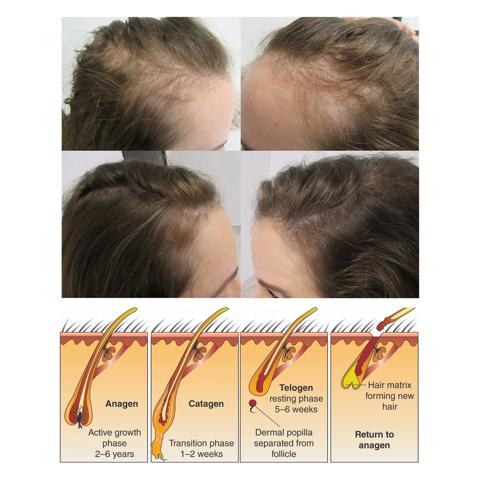 OEM и ODM, Собственная этикетка, экологически чистый рис, водный шампунь, мыло для волос, 100% рис, водный шампунь, бар