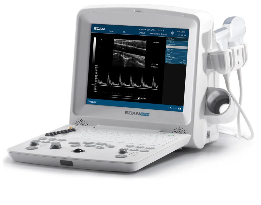 Edan DUS 60 Veterinary Ultrasound Scan Machine