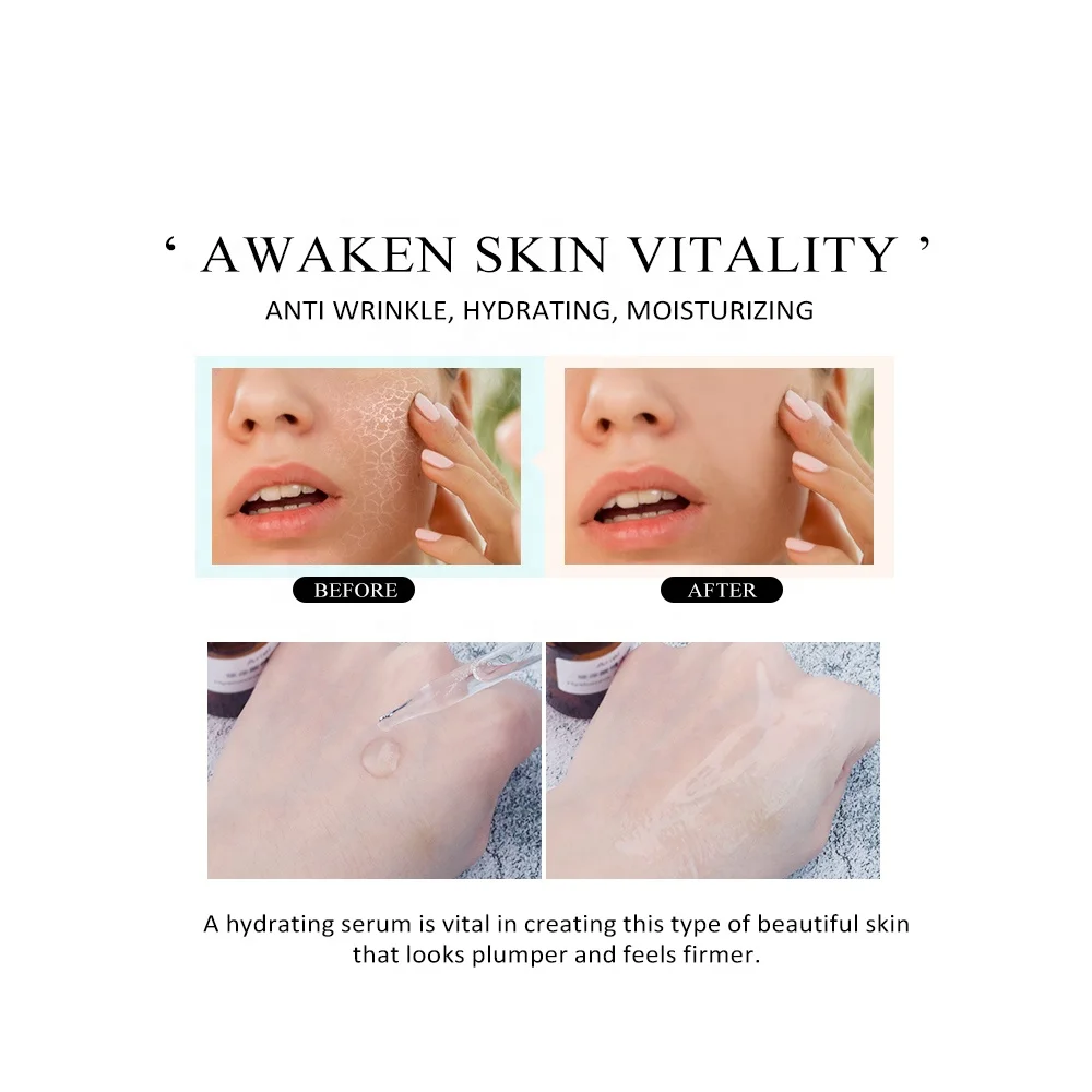 Private Label 30ml Deep Moisturizing Hydrating Hyaluronic Acid Chlorella Vulgaris Face Serum