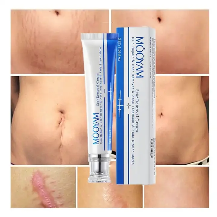 Effective Scar Removal Cream Hot Sale Skin Repair Fade Stretch Marks Scar Remover Acne Treatment 30g MOOYAM Removal Scar Cream