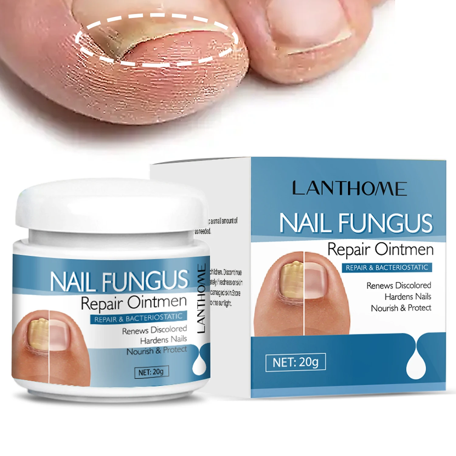 Nail Fungus Treatments Serum Cream Anti Fungal Foot Toe Nails Repair Gel Anti-Infection Onychomycosis Paronychia Care Ointment