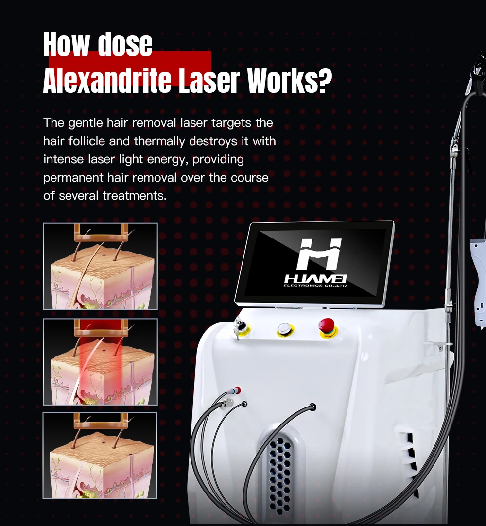 Alexandrite Long Pulse 1064nm Alexandrite Laser Hair Removal 755nm Alexandrite Laser Machine