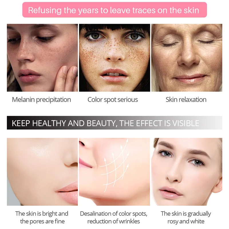 Vitamin C Anti Aging Wrinkle Acne Dark Spot Remover Black Skin Bleaching Whitening Face Cream