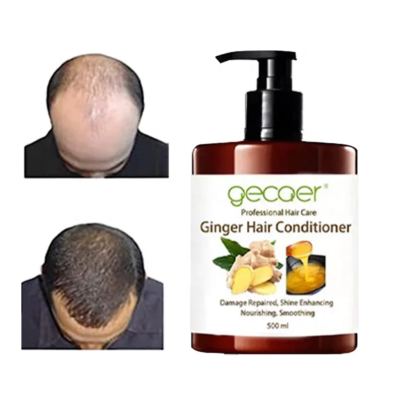 Wholesale Ginger organic fast Hair Growth Shampoo For Thinning Hair Anti Hair Loss Shampoo And Conditioner
