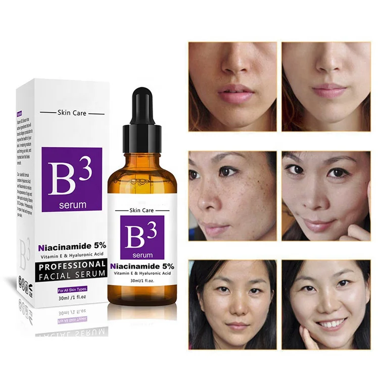 
Hot sales Niacinamide(Vitamin B3) Serum for Anti-aging and Wrinkles Acne Breakouts Hyperpigmentation 