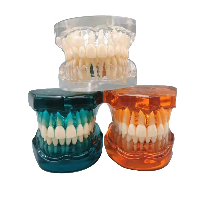 Медицинская обучающая школьная Студенческая прозрачная здоровая индивидуальная Стоматологическая Ортодонтическая модель зубов для