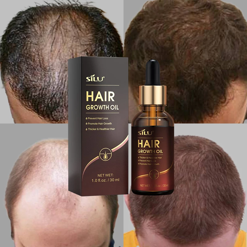 Hair buldness treatment oil original onion & bhringraj hair growth oil for mens or women
