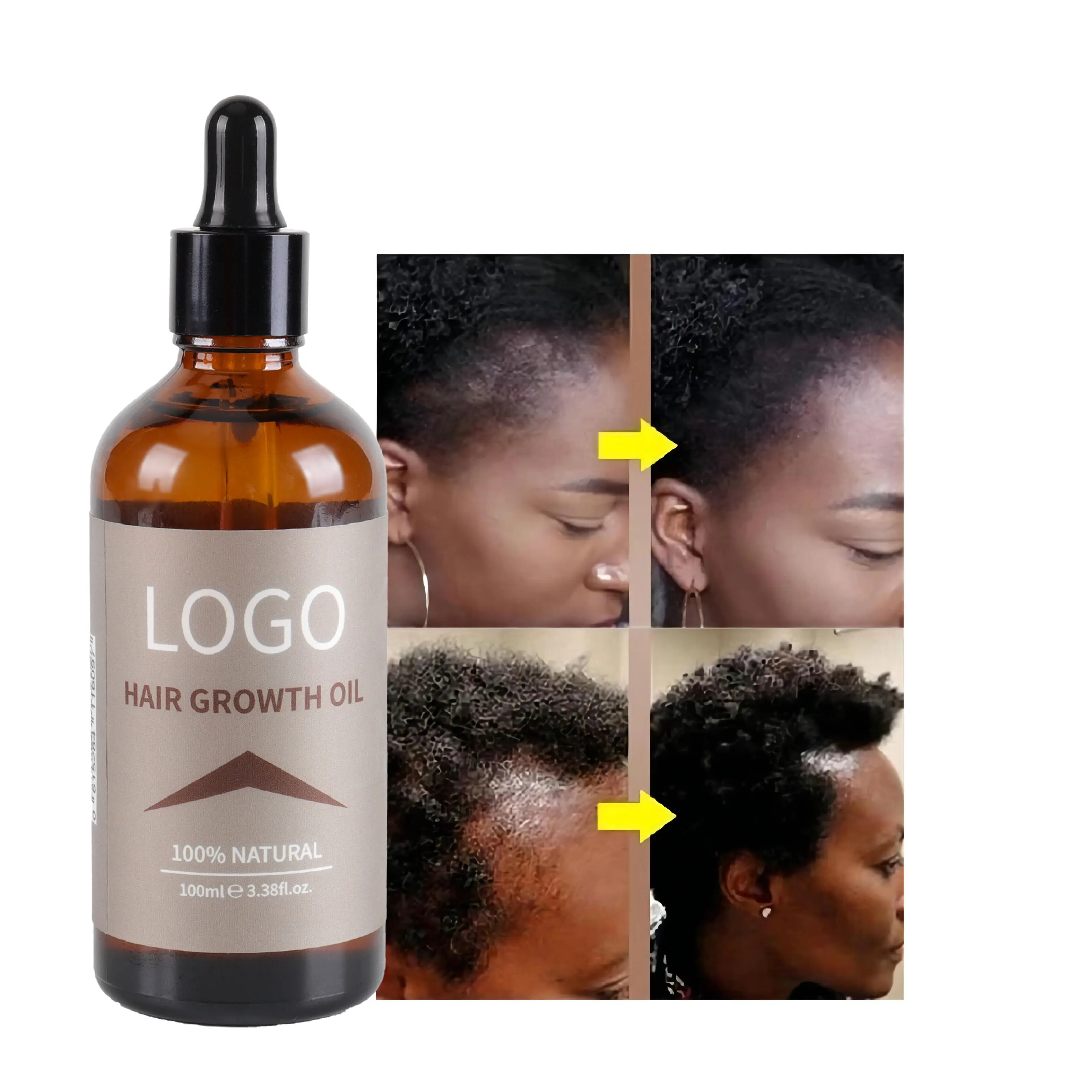 Custom Private Label Scalp Loss Leave in Ginger Biotin Germinal Regrowth Hair Oil Keratin Organic Roller Hair Growth Serum
