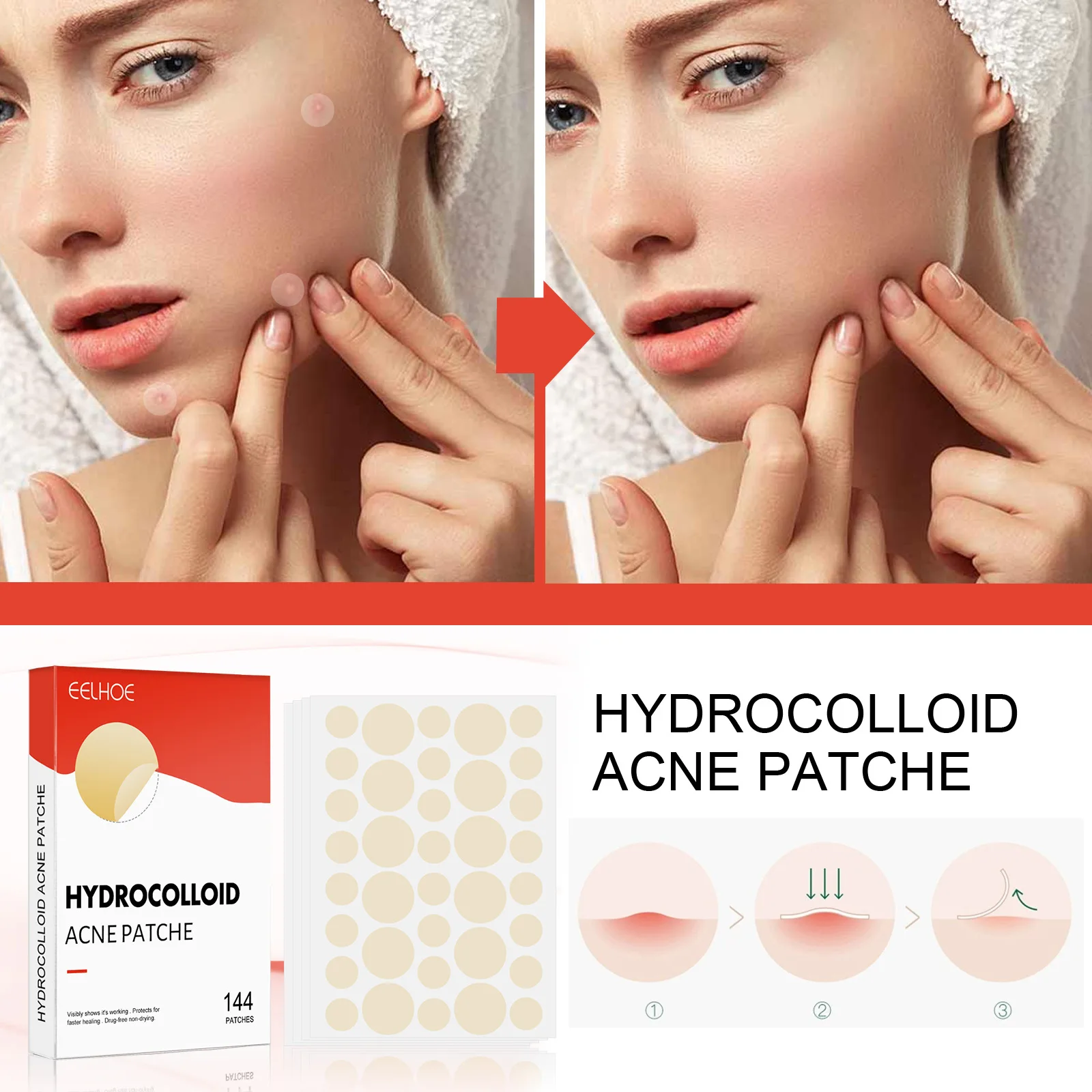 Safe skin protection and effective skin cleaning good quality hydrocolloid 144pcs/box acne patch