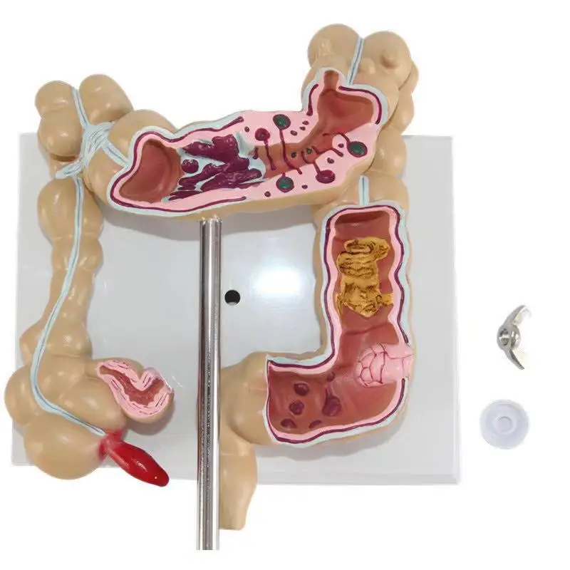 Advanced Medical Supplies Human Teaching Large Intestine Anatomy Model For School and hospital