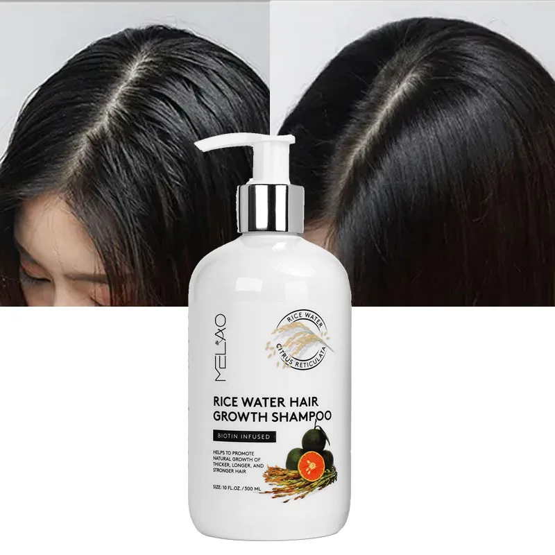 Vegan Hair Thickening Moisturizing Anti-Hair Loss Rice Shampoo Rice Water Hair Growth Shampoo