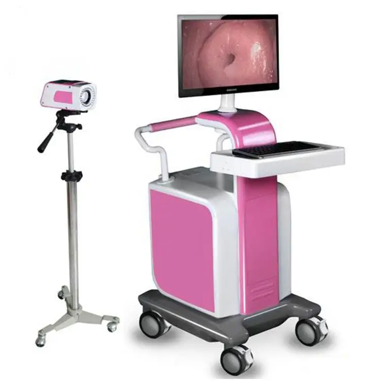 YSSW3303B High advantage colposcope trolley gynecology video colposcope