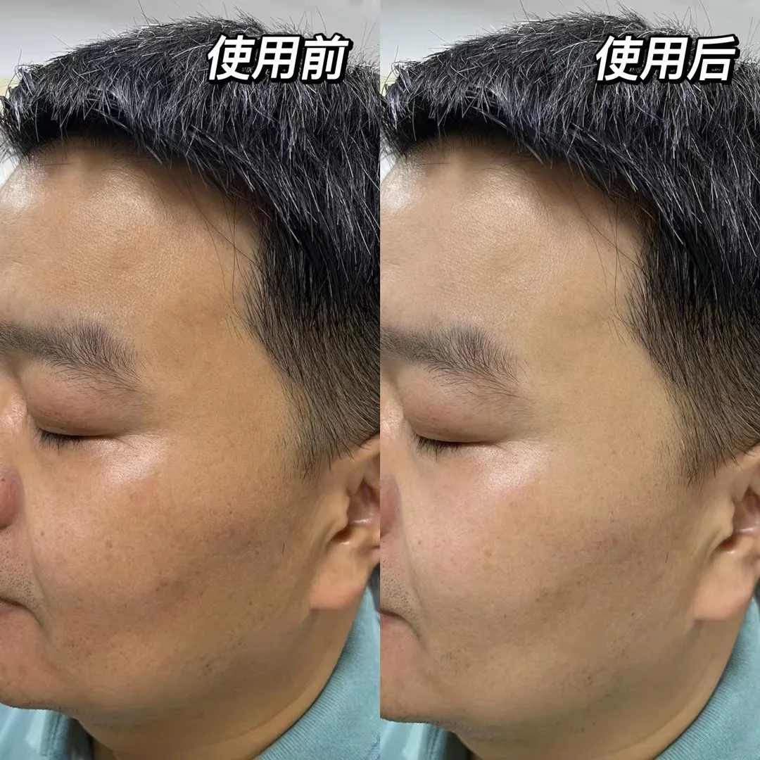 skin care products made in korea  day & night face lotion beauty facial anti acne aging skin care set